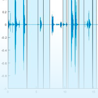 CIMNE researcher Alberto Tena publishes a study about COVID detection using machine learning